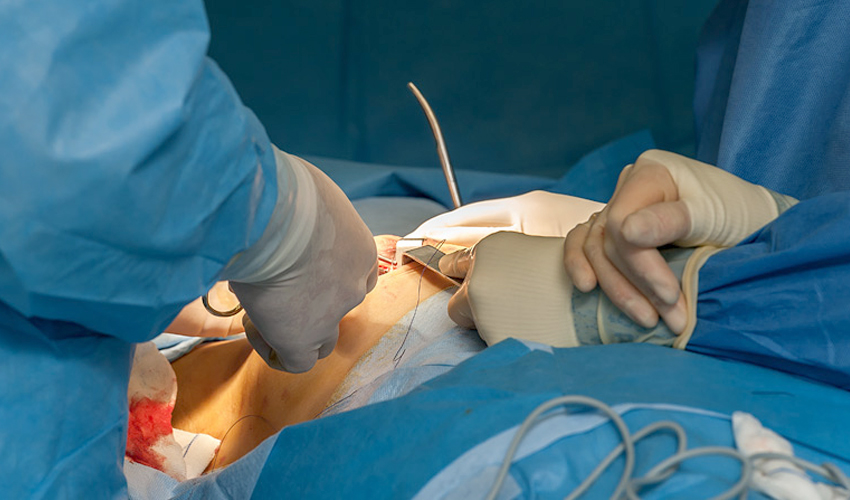 Top Breast Specialist Doctor In Nerul